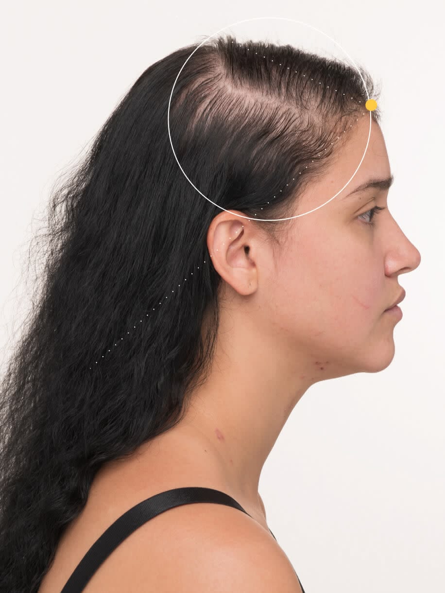 Hair Fall and Weak Roots Care